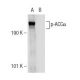 p-ACCα Antibody (F-2) - Western Blotting - Image 146930 