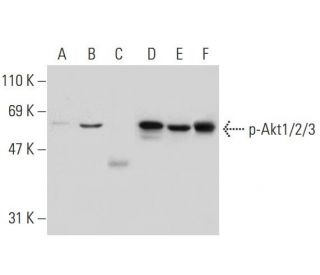 p-Akt1/2/3 Antibody (11E6) | SCBT - Santa Cruz Biotechnology