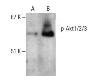 p-Akt1/2/3 Antibody (B-5) | SCBT - Santa Cruz Biotechnology