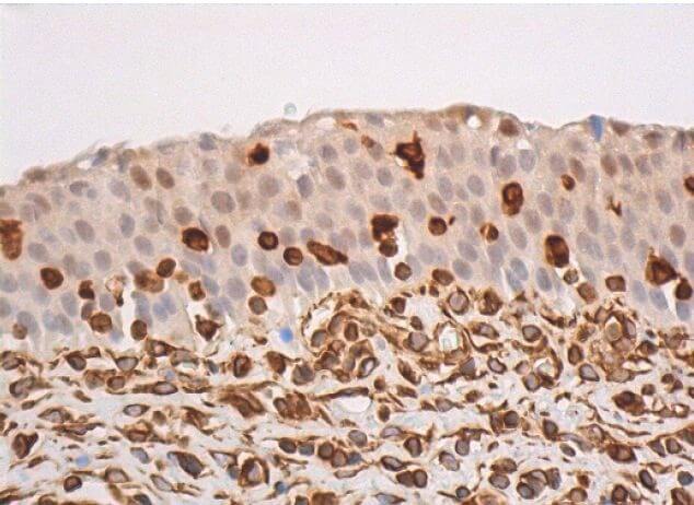けんち p-Akt1/2/3 Antibody (C-11) | SCBT - Santa Cruz Biotechnology