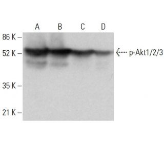 western blotting image from recommended p-Akt1/2/3 (C-11) monoclonal antibody replacement. Image 376603