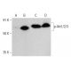 western blotting image from recommended p-Akt1/2/3 (B-5) monoclonal antibody replacement. Image 376860