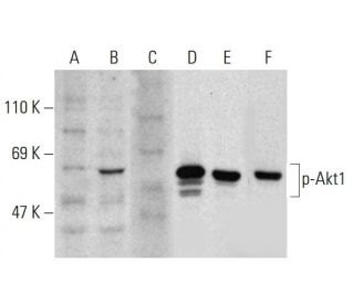 p-Akt1 Antibody (104A282) - Western Blotting - Image 136722 