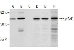 p-Akt1 Antibody (5.Ser 473) | SCBT - Santa Cruz Biotechnology
