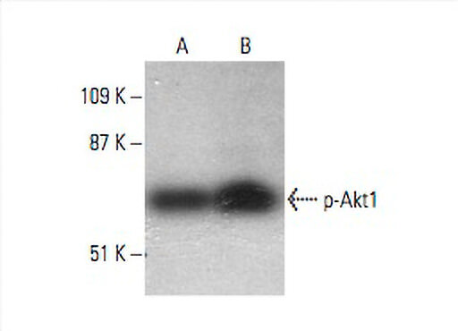 p-Akt1 Antibody (5.Ser 473) | SCBT - Santa Cruz Biotechnology