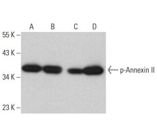 p-Annexin-2/ANXA2 Antibody (85.Tyr 24) - Western Blotting - Image 377608 
