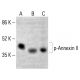 p-Annexin-2/ANXA2 Antibody (85.Tyr 24) - Western Blotting - Image 412847