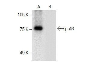 Androgen Receptor Antibody E 6 SCBT Santa Cruz Biotechnology