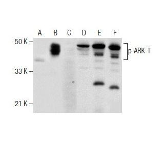 p-ARK-1 Antibody (95.Thr 288) - Western Blotting - Image 159333