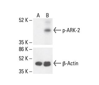 p-ARK-2 Antibody (66.Thr 232) - Western Blotting - Image 411976