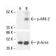 p-ARK-2 Antibody (66.Thr 232) - Western Blotting - Image 411976