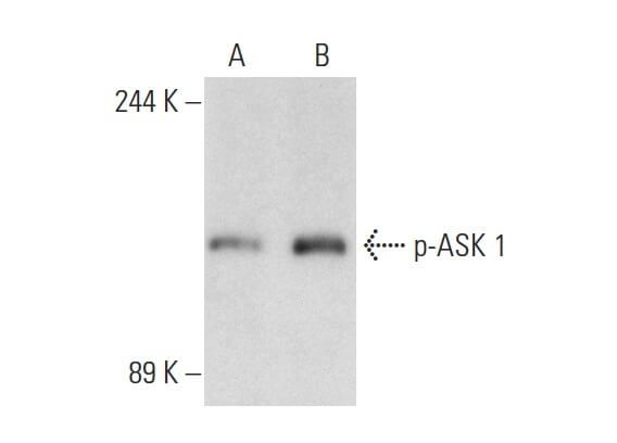 p-ASK 1 Antibody (B-5) | SCBT - Santa Cruz Biotechnology