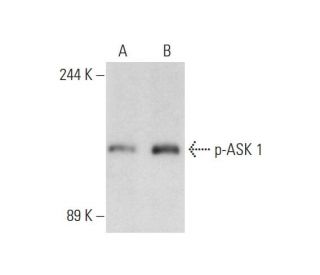 western blotting image from recommended p-ASK 1 (B-5) monoclonal antibody replacement. Image 130081
