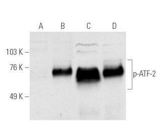 western blotting image from recommended p-ATF-2 (F-1) monoclonal antibody replacement. Image 812