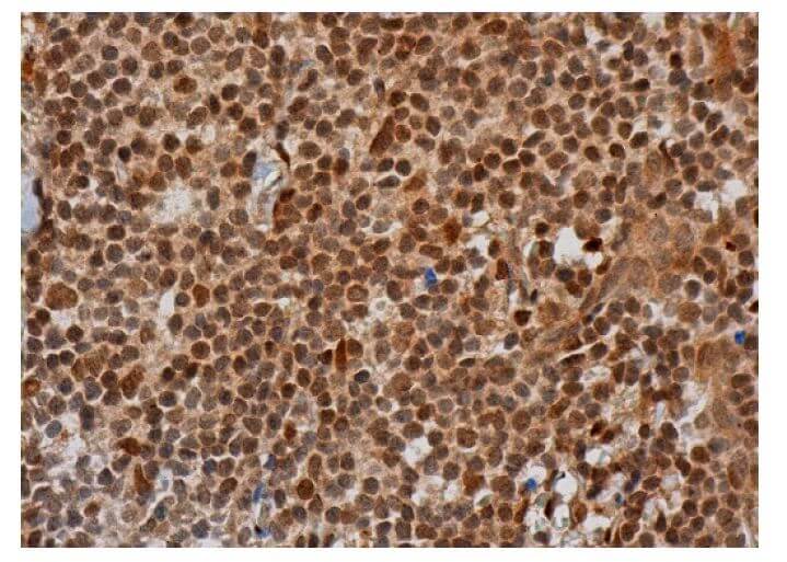 P Atm Antibody