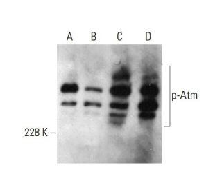 p-Atm Antibody (10H11.E12) - Western Blotting - Image 385740 