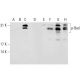 This polyclonal antibody has been discontinued. See our recommended <a href="p-bad-antibody-c-10">p-Bad (C-10)</a> monoclonal antibody (sample data shown). western blotting image from recommended p-Bad (C-10) monoclonal antibody replacement. Image 132658