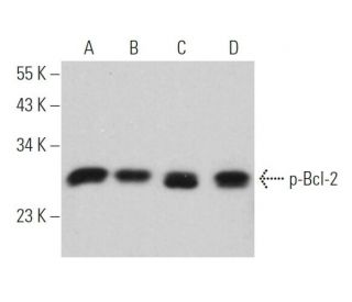 western blotting image from recommended p-Bcl-2 (367.Ser 70) monoclonal antibody replacement. Image 377314