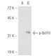 p-Bcl10 Antibody (6D3) - Western Blotting - Image 48252