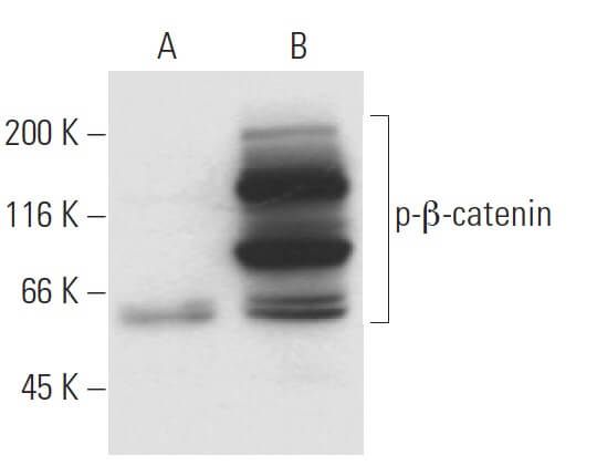 Anti P B Catenin Antibody 1b11 Scbt Santa Cruz Biotechnology