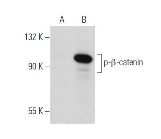 western blotting image from recommended p-beta-catenin (BC-22) monoclonal antibody replacement. Image 34784