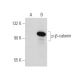 western blotting image from recommended p-beta-catenin (BC-22) monoclonal antibody replacement. Image 34784