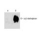 p-β-dystroglycan Antibody (pY892.27.1) - Western Blotting - Image 133195