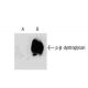 p-β-dystroglycan Antibody (pY892.27.1) - Western Blotting - Image 133241 