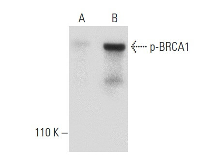 p BRCA1 Antibody G 4 SCBT Santa Cruz Biotechnology