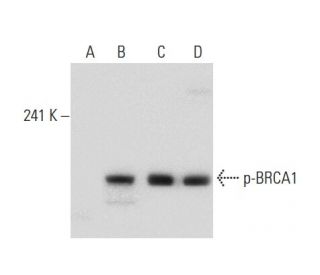 western blotting image from recommended p-BRCA1 (G-4) monoclonal antibody replacement. Image 133097