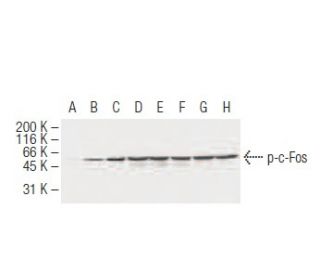 p-Fos/c-Fos Antibody (34E4) - Western Blotting - Image 62919 