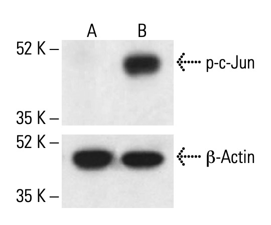 p-c-Jun Antibody (KM-1) | SCBT - Santa Cruz Biotechnology