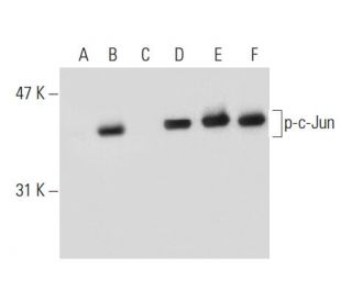 western blotting image from recommended p-c-Jun (KM-1) monoclonal antibody replacement. Image 133105