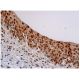 p-Myc Antibody (E-3) - Immunohistochemistry - Image 347954