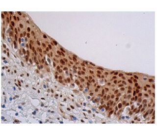 immunohistochemistry image from recommended p-Myc (E-3) monoclonal antibody replacement. Image 347954