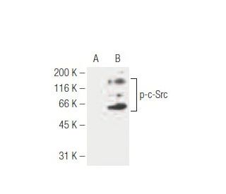 p-c-Src/Src Antibody (9A6) - Western Blotting - Image 62939 