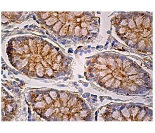 p-Src Antibody (H-3) | SCBT - Santa Cruz Biotechnology p-Src Antibody (H-3) | SCBT - Santa Cruz Biotechnology