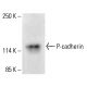 P-cadherin Antibody (12H6) - Western Blotting - Image 413100