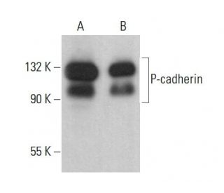 P-cadherin Antibody (6A9) - Western Blotting - Image 378444 