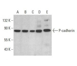 P-cadherin Antibody (D-6) - Western Blotting - Image 354488 
