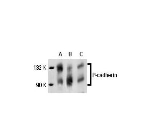 western blotting image from recommended P-cadherin (A-10) monoclonal antibody replacement. Image 19558