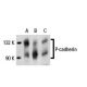 western blotting image from recommended P-cadherin (A-10) monoclonal antibody replacement. Image 19558