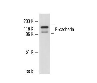 P-cadherin Antibody (6A9) - Western Blotting - Image 10475