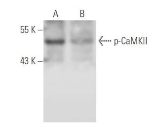 western blotting image from recommended p-CaMKII (22B1) monoclonal antibody replacement. Image 14776