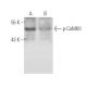 western blotting image from recommended p-CaMKII (22B1) monoclonal antibody replacement. Image 14776