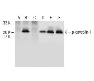 western blotting image from recommended p-caveolin-1 (B-9) monoclonal antibody replacement. Image 150620