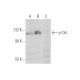 p-Cbl Antibody (pY700.47) - Western Blotting - Image 64694