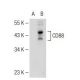 p-CD88 Antibody (32-G1) - Western Blotting - Image 113993 
