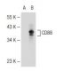 p-CD88 Antibody (32-G1) - Western Blotting - Image 113995 