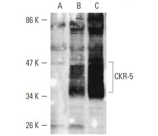 p-CKR-5 Antibody (V14/2) - Western Blotting - Image 9230